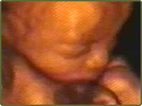 Imagen del escáner 4D